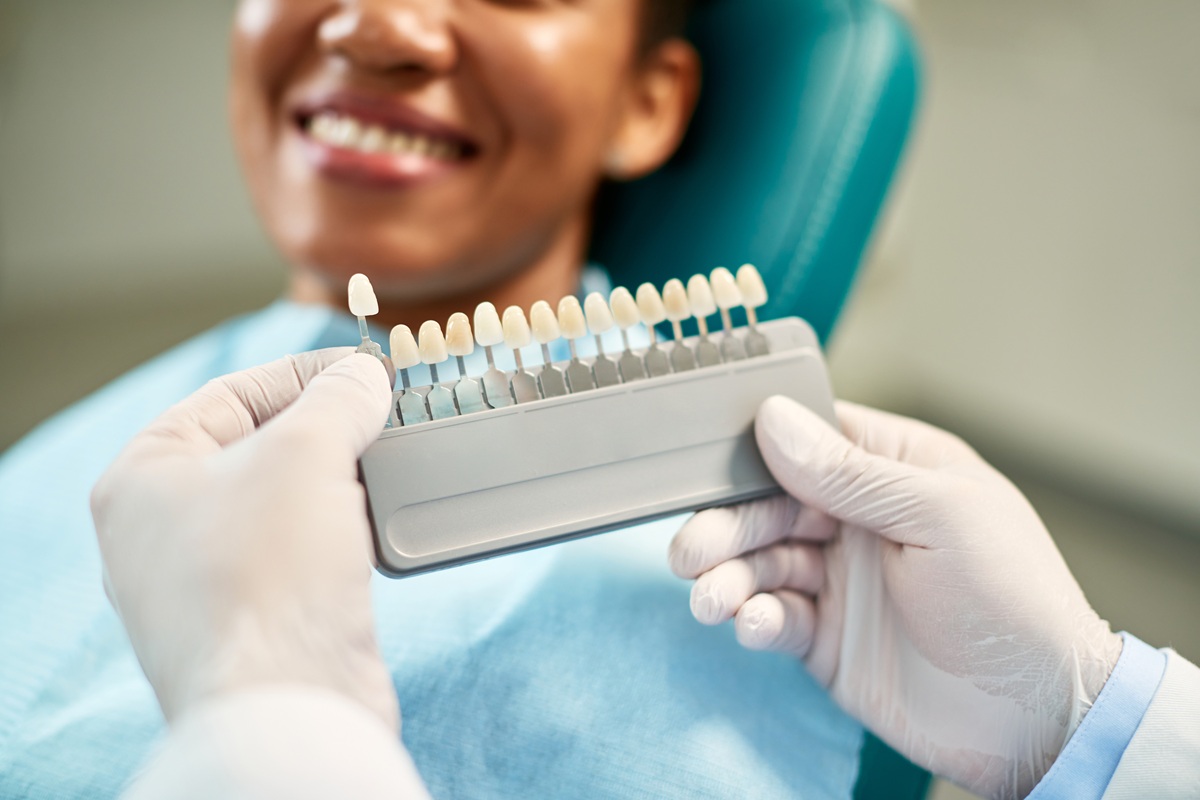 Dental veneer shade matching consultation